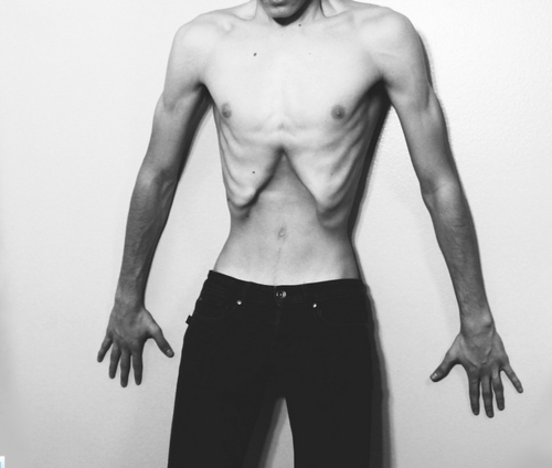 anorexia tumblr pictures